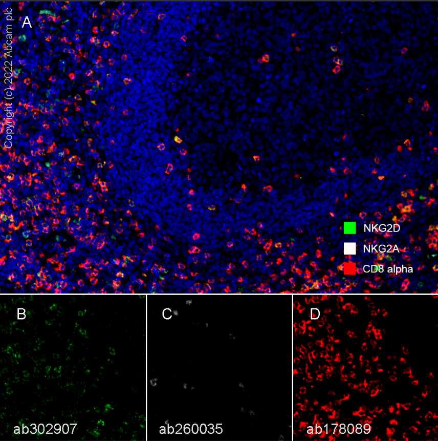 Multiplex immunohistochemistry - Anti-NKG2A antibody [EPR23737-127] (ab260035), expandable thumbnail