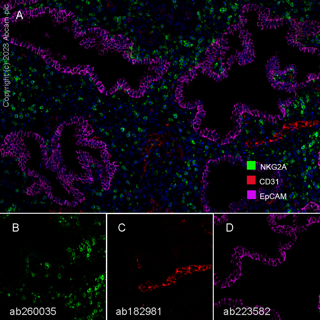 Multiplex immunohistochemistry - Anti-NKG2A antibody [EPR23737-127] (ab260035), expandable thumbnail