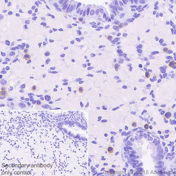Immunohistochemistry (Formalin/PFA-fixed paraffin-embedded sections) - Anti-NKG2A + NKG2E + NKG2C antibody [EPR22137] (AB224699)