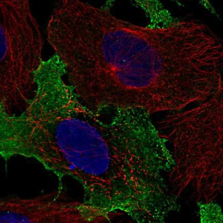 Immunocytochemistry/ Immunofluorescence - Anti-NKG2C antibody (AB220898)