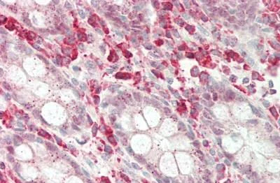 Immunohistochemistry (Formalin/PFA-fixed paraffin-embedded sections) - Anti-NKG2C antibody - N-terminal (AB230900)