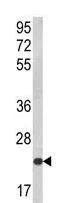 Western blot - Anti-NKG2C antibody - N-terminal (AB230900)