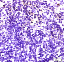 Immunohistochemistry (Formalin/PFA-fixed paraffin-embedded sections) - Anti-NKG2D antibody (AB203353)