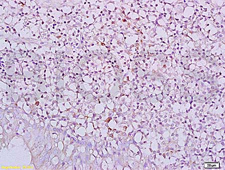 Immunohistochemistry (Formalin/PFA-fixed paraffin-embedded sections) - Anti-NKG2D antibody (AB203353)