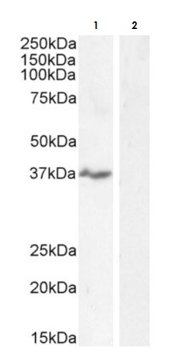 Western blot - Anti-NKG2D antibody (AB36136), expandable thumbnail