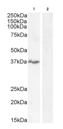 Western blot - Anti-NKG2D antibody (AB36136)