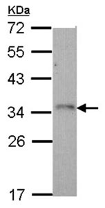 Western blot - Anti-NKG2D antibody (AB96606)