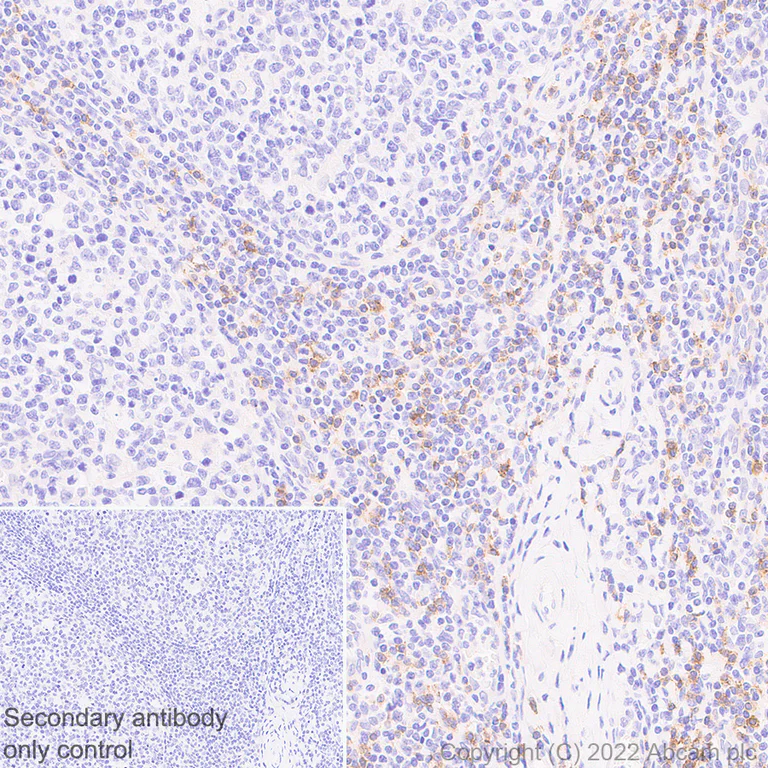 Immunohistochemistry - Anti-NKG2D antibody [EPR24072-342] - BSA and Azide free (AB302908)