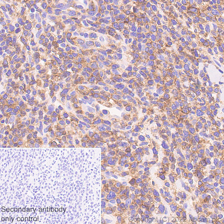 Immunohistochemistry - Anti-NKG2D antibody [EPR24072-342] - BSA and Azide free (AB302908)