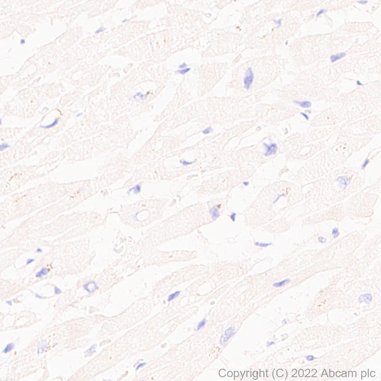 Immunohistochemistry - Anti-NKG2D antibody [EPR24072-342] - BSA and Azide free (AB302908)