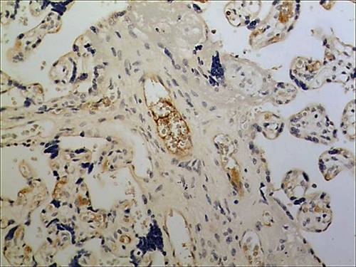 Immunohistochemistry (Formalin/PFA-fixed paraffin-embedded sections) - Anti-NKG2D antibody [MM0489-10R27] (AB89807)