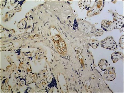 Immunohistochemistry (Formalin/PFA-fixed paraffin-embedded sections) - Anti-NKG2D antibody [MM0489-10R27] (AB89807)