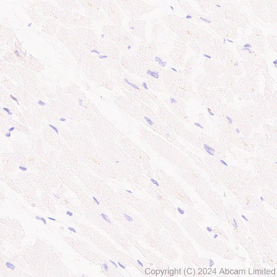 Immunohistochemistry (Formalin/PFA-fixed paraffin-embedded sections) - Anti-NKG2D antibody [RM1173] (AB319162), expandable thumbnail