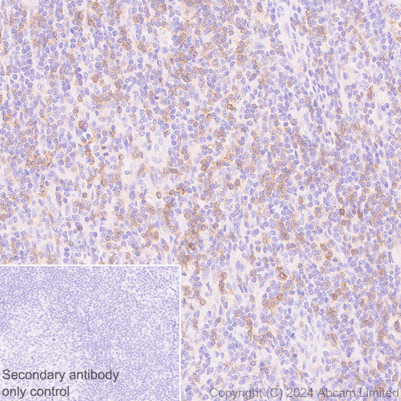 Immunohistochemistry (Formalin/PFA-fixed paraffin-embedded sections) - Anti-NKG2D antibody [RM1173] (ab319162), expandable thumbnail