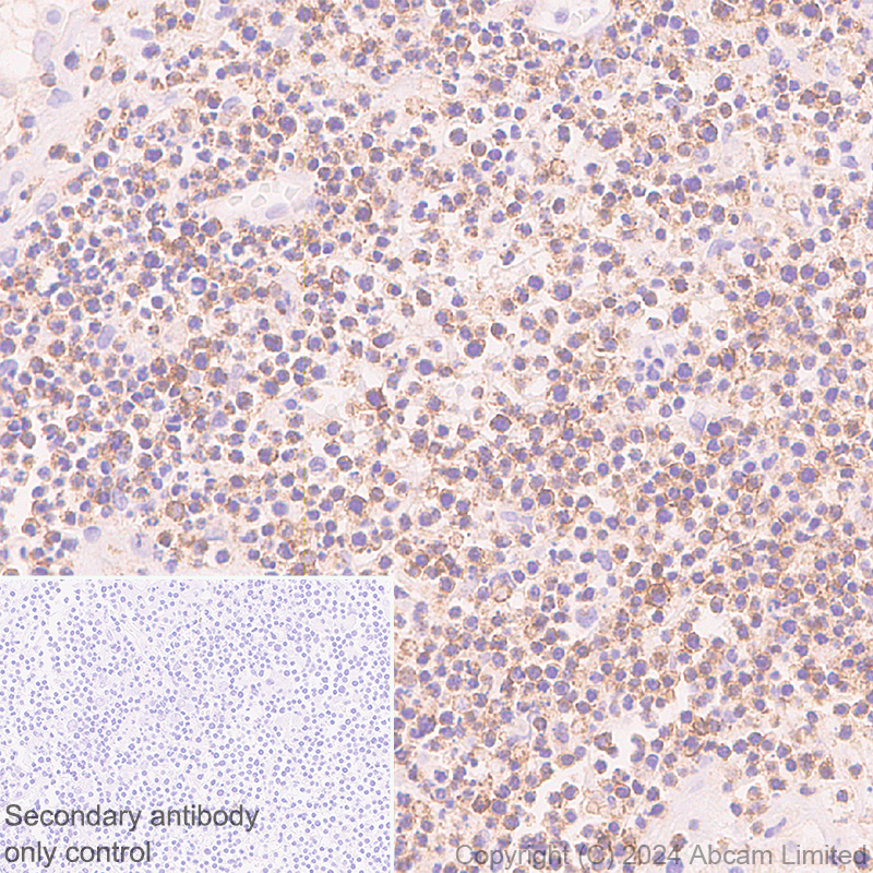 Immunohistochemistry (Formalin/PFA-fixed paraffin-embedded sections) - Anti-NKG2D antibody [RM1173] (ab319162), expandable thumbnail