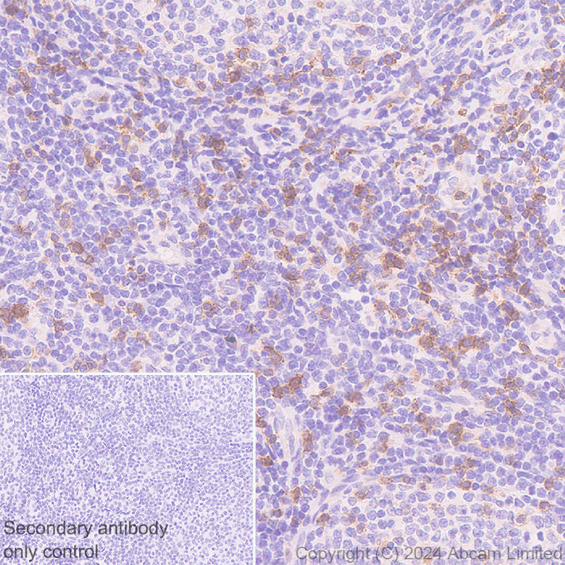 Immunohistochemistry (Formalin/PFA-fixed paraffin-embedded sections) - Anti-NKG2D antibody [RM1173] (ab319162), expandable thumbnail