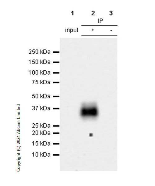 Immunoprecipitation - Anti-NKG2D antibody [RM1173] (AB319162), expandable thumbnail