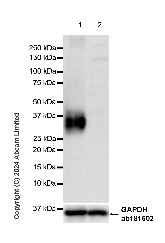 Western blot - Anti-NKG2D antibody [RM1173] (ab319162), expandable thumbnail