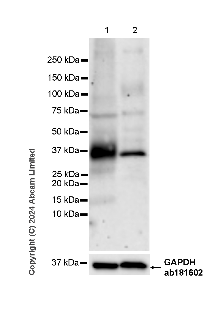 Western blot - Anti-NKG2D antibody [RM1173] (ab319162), expandable thumbnail
