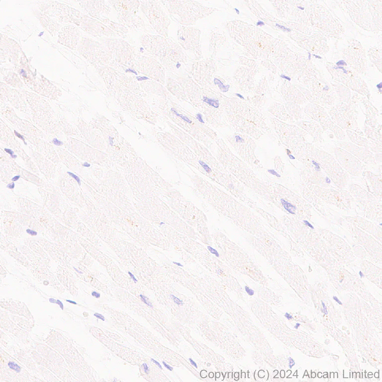 Immunohistochemistry (Formalin/PFA-fixed paraffin-embedded sections) - Anti-NKG2D antibody [RM1173] - BSA and Azide free (AB319163)