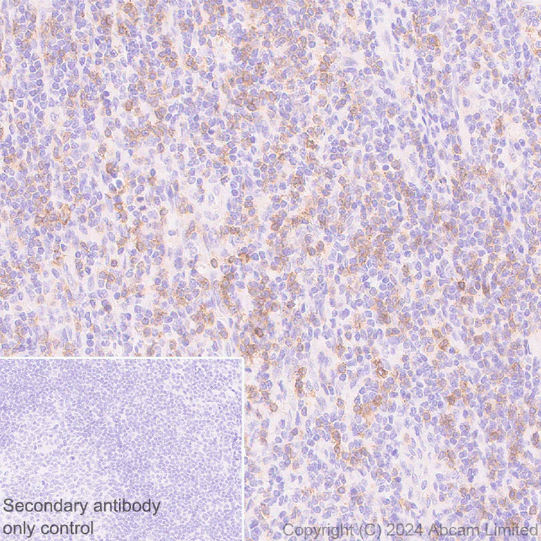 Immunohistochemistry (Formalin/PFA-fixed paraffin-embedded sections) - Anti-NKG2D antibody [RM1173] - BSA and Azide free (AB319163)