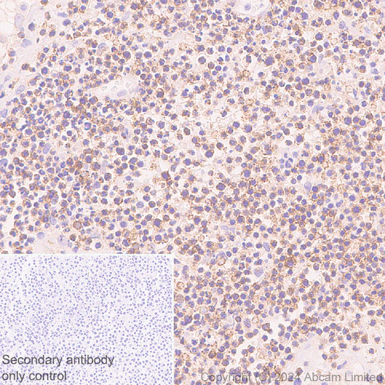 Immunohistochemistry (Formalin/PFA-fixed paraffin-embedded sections) - Anti-NKG2D antibody [RM1173] - BSA and Azide free (AB319163)