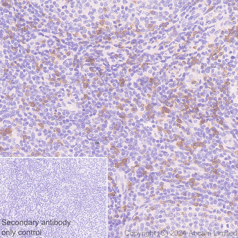 Immunohistochemistry (Formalin/PFA-fixed paraffin-embedded sections) - Anti-NKG2D antibody [RM1173] - BSA and Azide free (AB319163)