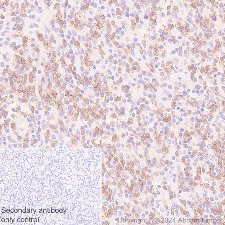 Immunohistochemistry (Formalin/PFA-fixed paraffin-embedded sections) - Anti-NKG2D antibody [RM1173] - BSA and Azide free (AB319163)