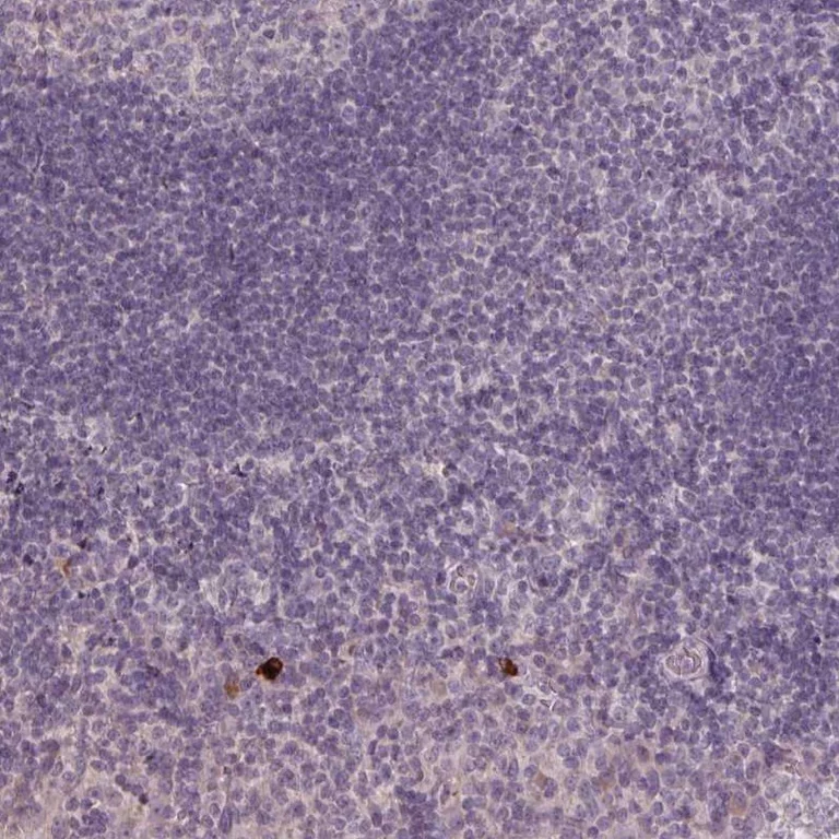 Immunohistochemistry (Formalin/PFA-fixed paraffin-embedded sections) - Anti-NKG2E antibody (AB247146)