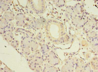 Immunohistochemistry (Formalin/PFA-fixed paraffin-embedded sections) - Anti-NKIRAS1 antibody (AB235310), expandable thumbnail