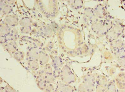 Immunohistochemistry (Formalin/PFA-fixed paraffin-embedded sections) - Anti-NKIRAS1 antibody (AB235310)