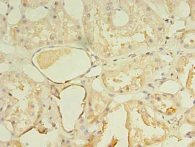 Immunohistochemistry (Formalin/PFA-fixed paraffin-embedded sections) - Anti-NKIRAS1 antibody (AB235310)