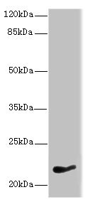 Western blot - Anti-NKIRAS1 antibody (AB235310), expandable thumbnail