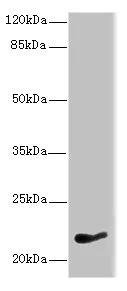 Western blot - Anti-NKIRAS1 antibody (AB235310)