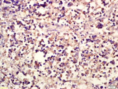 Immunohistochemistry (Formalin/PFA-fixed paraffin-embedded sections) - Anti-NKp30 antibody (AB203390)