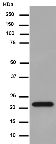 Western blot - Anti-NKp30 antibody [EPR14509] (AB186425)
