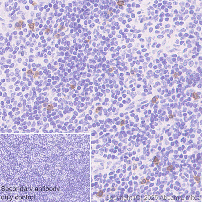 Immunohistochemistry (Formalin/PFA-fixed paraffin-embedded sections) - Anti-NKp46/NCR1 antibody [RM1303] (AB324692)