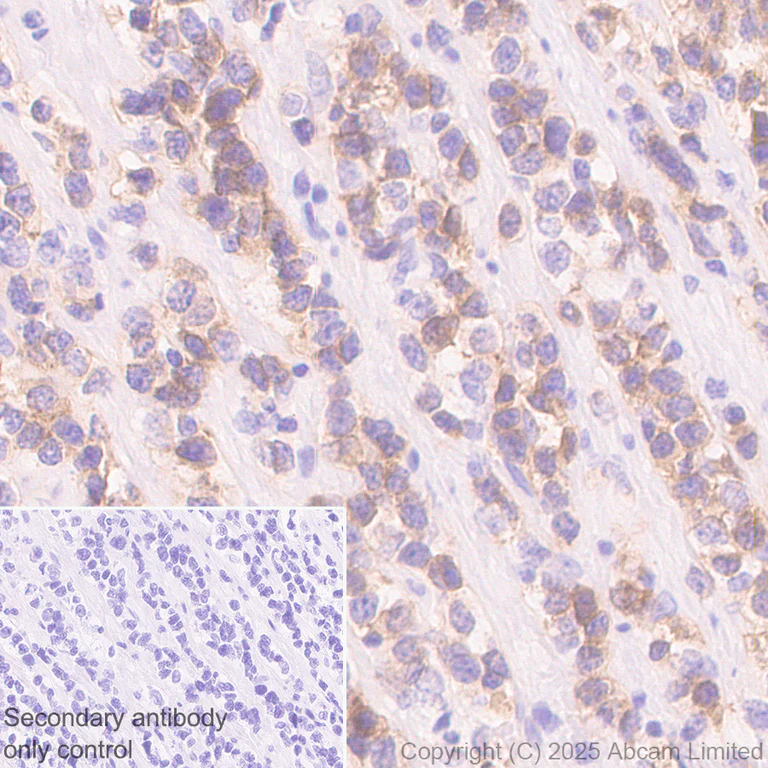Immunohistochemistry (Formalin/PFA-fixed paraffin-embedded sections) - Anti-NKp46/NCR1 antibody [RM1303] (AB324692)