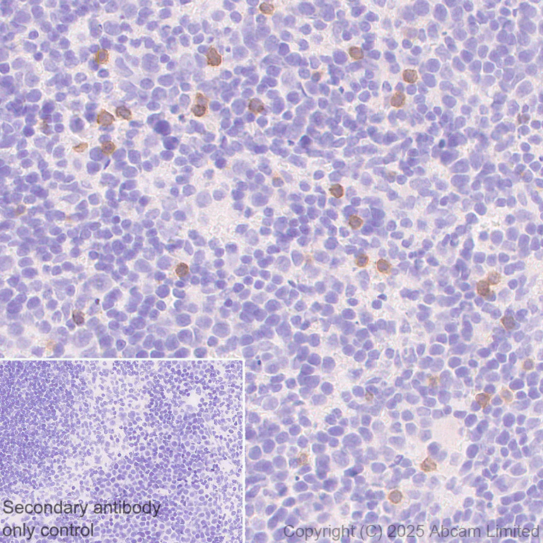 Immunohistochemistry (Formalin/PFA-fixed paraffin-embedded sections) - Anti-NKp46/NCR1 antibody [RM1303] (AB324692)