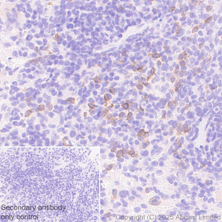 Immunohistochemistry (Formalin/PFA-fixed paraffin-embedded sections) - Anti-NKp46/NCR1 antibody [RM1303] (AB324692)