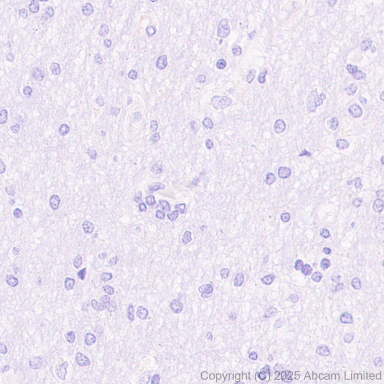 Immunohistochemistry (Formalin/PFA-fixed paraffin-embedded sections) - Anti-NKp46/NCR1 antibody [RM1303] (AB324692)