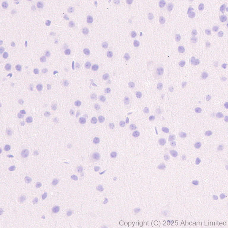 Immunohistochemistry (Formalin/PFA-fixed paraffin-embedded sections) - Anti-NKp46/NCR1 antibody [RM1303] (AB324692)