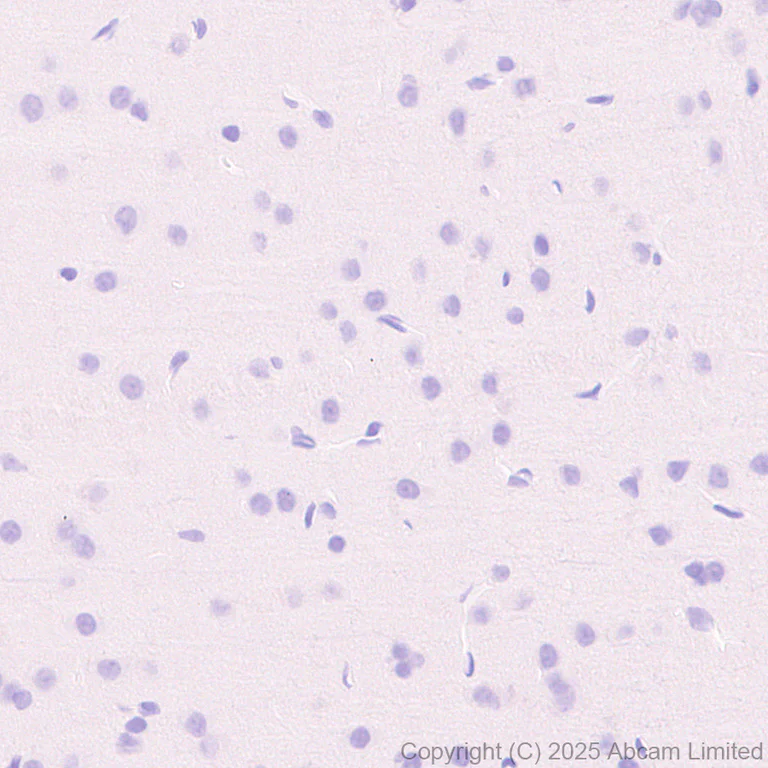 Immunohistochemistry (Formalin/PFA-fixed paraffin-embedded sections) - Anti-NKp46/NCR1 antibody [RM1303] (AB324692)