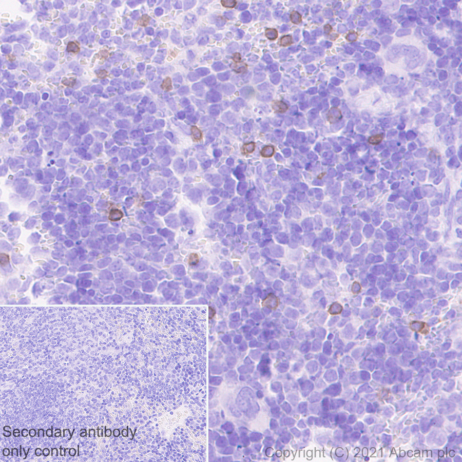 Immunohistochemistry (Formalin/PFA-fixed paraffin-embedded sections) - Anti-NKR-P1C antibody [EPR22990-31] (AB289542), expandable thumbnail
