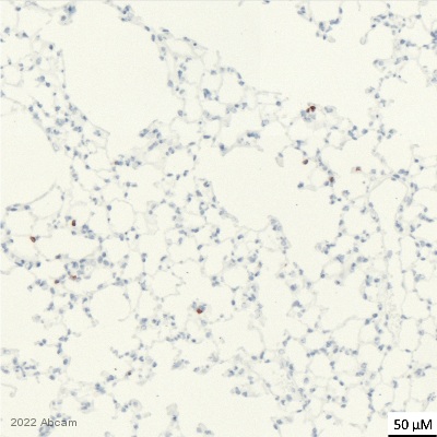 Immunohistochemistry (Formalin/PFA-fixed paraffin-embedded sections) - Anti-NKR-P1C antibody [EPR22990-31] (ab289542), expandable thumbnail