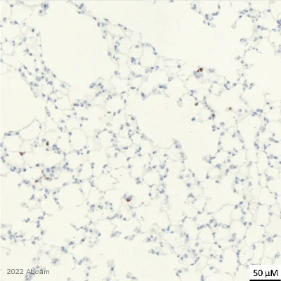 Immunohistochemistry (Formalin/PFA-fixed paraffin-embedded sections) - Anti-NKR-P1C antibody [EPR22990-31] (AB289542)