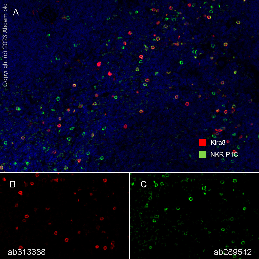 Multiplex immunohistochemistry - Anti-NKR-P1C antibody [EPR22990-31] (ab289542), expandable thumbnail
