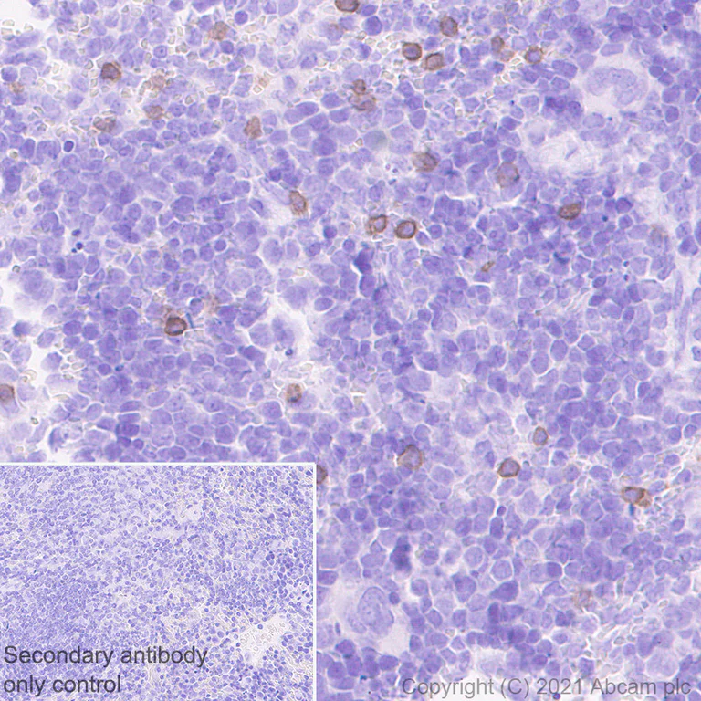 Immunohistochemistry (Formalin/PFA-fixed paraffin-embedded sections) - Anti-NKR-P1C/NK1.1 antibody [EPR22990-31] (AB289542)