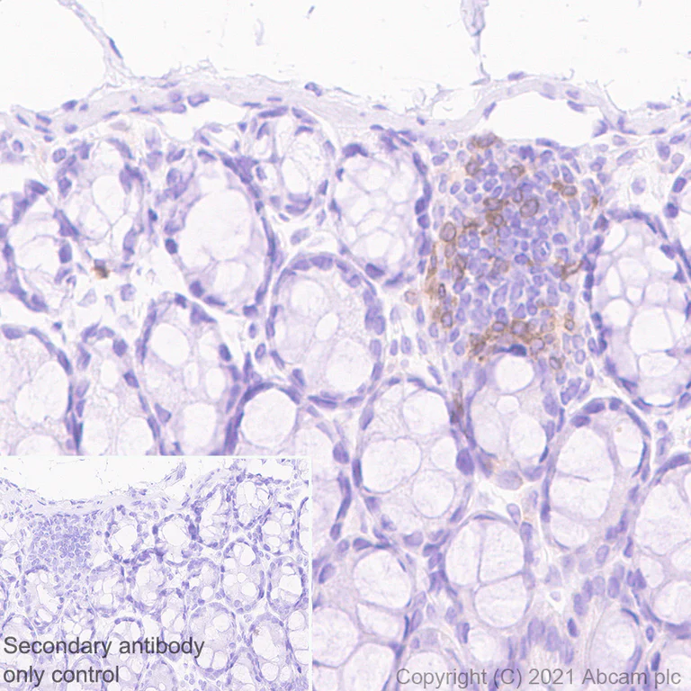 Immunohistochemistry (Formalin/PFA-fixed paraffin-embedded sections) - Anti-NKR-P1C/NK1.1 antibody [EPR22990-31] (AB289542)