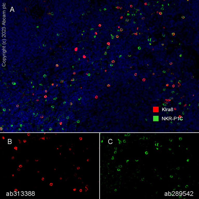 Multiplex immunohistochemistry - Anti-NKR-P1C/NK1.1 antibody [EPR22990-31] (AB289542)